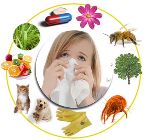 Alergias - blog farmacia 24h - Farmacia 24 horas Palma | Farmacia Balanguera