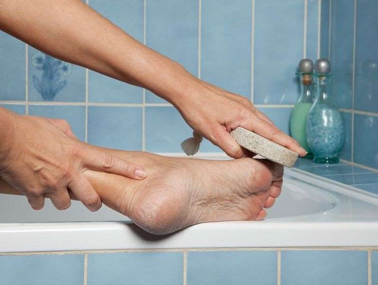 Cuidados de los pies consejos practicos - blog farmacia 24h - Farmacia 24 horas Palma | Farmacia Balanguera