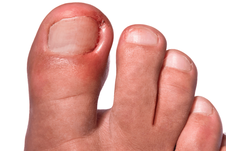 Cuidados de los pies consejos practicos - blog farmacia 24h - Farmacia 24 horas Palma | Farmacia Balanguera
