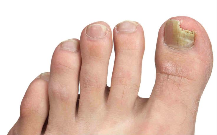 Cuidados de los pies consejos practicos - blog farmacia 24h - Farmacia 24 horas Palma | Farmacia Balanguera