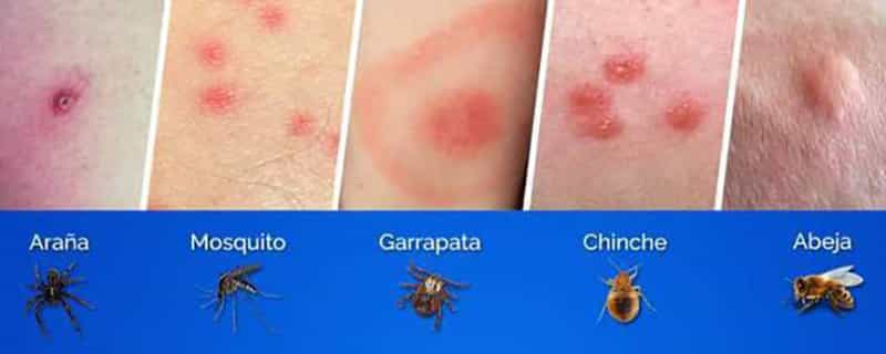 Pagina 8 - blog farmacia - Farmacia 24 horas Palma | Farmacia Balanguera